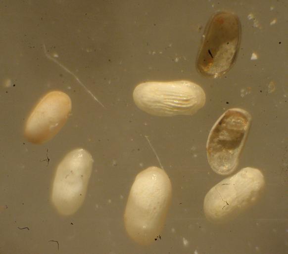 Ostracoda fossili